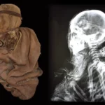 Thanks to X-rays, researchers were able to examine the burials in a non-invasive way. In the photo: the mummy of a 6-year-old child, who died as a result of a head injury, and its X-ray. Photo by Dr. Dagmara Socha.