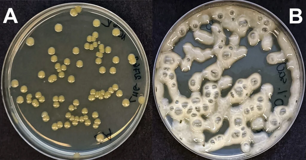  A. Colonies of Cronobacter sakazakii bacteria grown on a solid microbiological medium. B. Colonies of the same bacteria in the presence of sucrose in the medium (abundant exopolysaccharides are visible; gas bubbles indicate fermentation). Source: Faculty of Biology, University of Warsaw