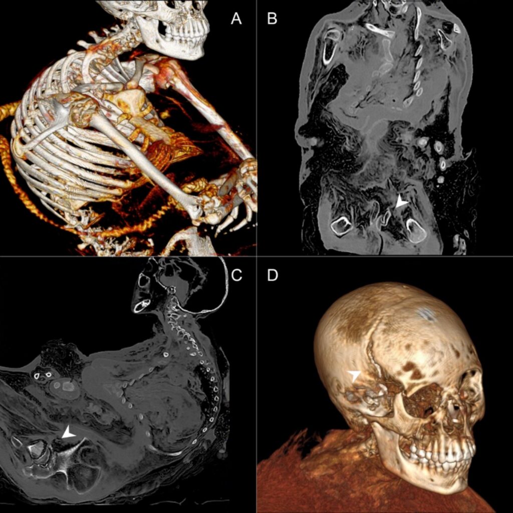 1-s2.0-S2352409X26000453-gr3_lrg