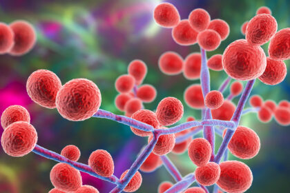candida-albicans