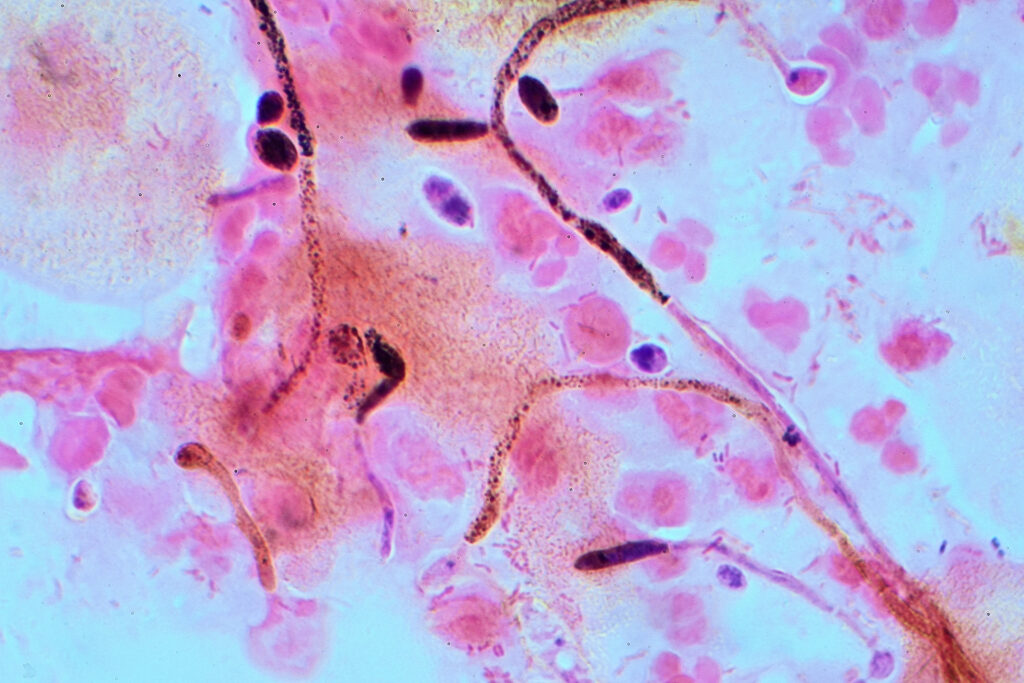candida-albicans