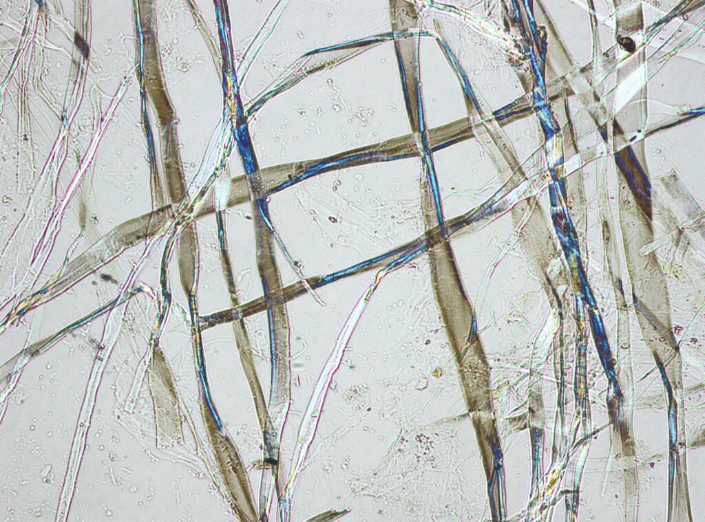 str.-87-–-fig.-1