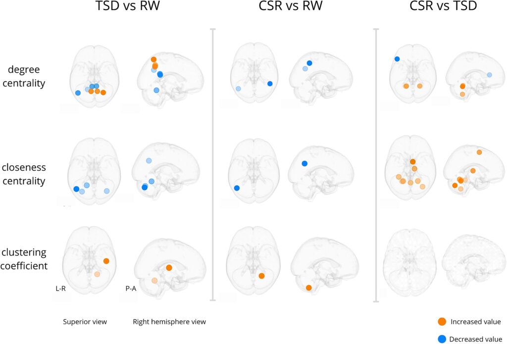 zsag030f4-SLEEP_regional_changes