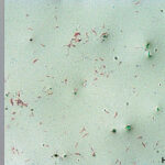 Mycobacterium-kansasii_01.