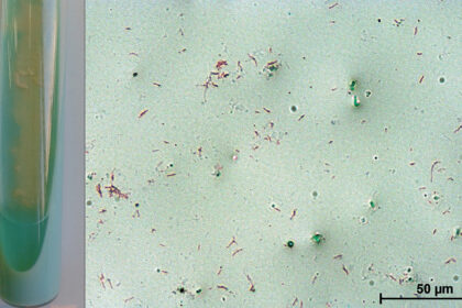 Mycobacterium-kansasii_01.